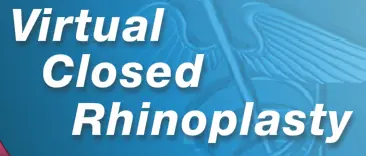 Surgery Squad: Virtual Closed Rhinoplasty logo