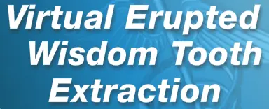 Surgery Squad: Virtual Erupted Wisdom Tooth Extraction logo