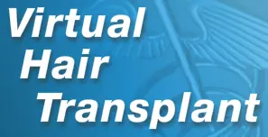 Surgery Squad: Virtual Hair Transplant logo